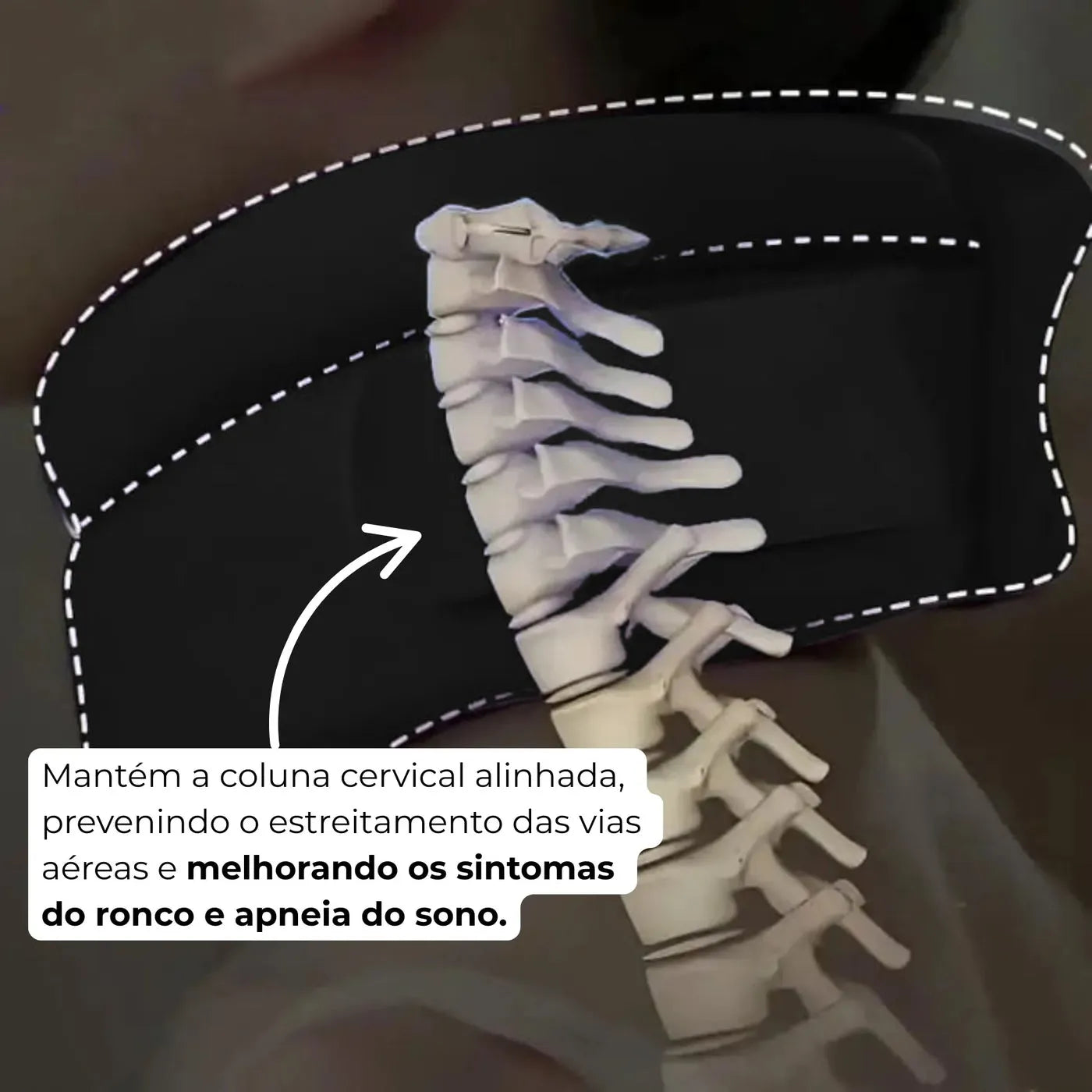 Sonare - Suporte Ergonômico para Cervical